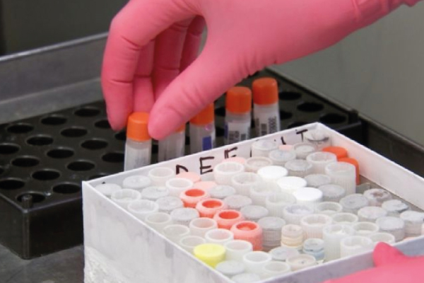 ¿Qué es una Prueba Rápida Multidroga?